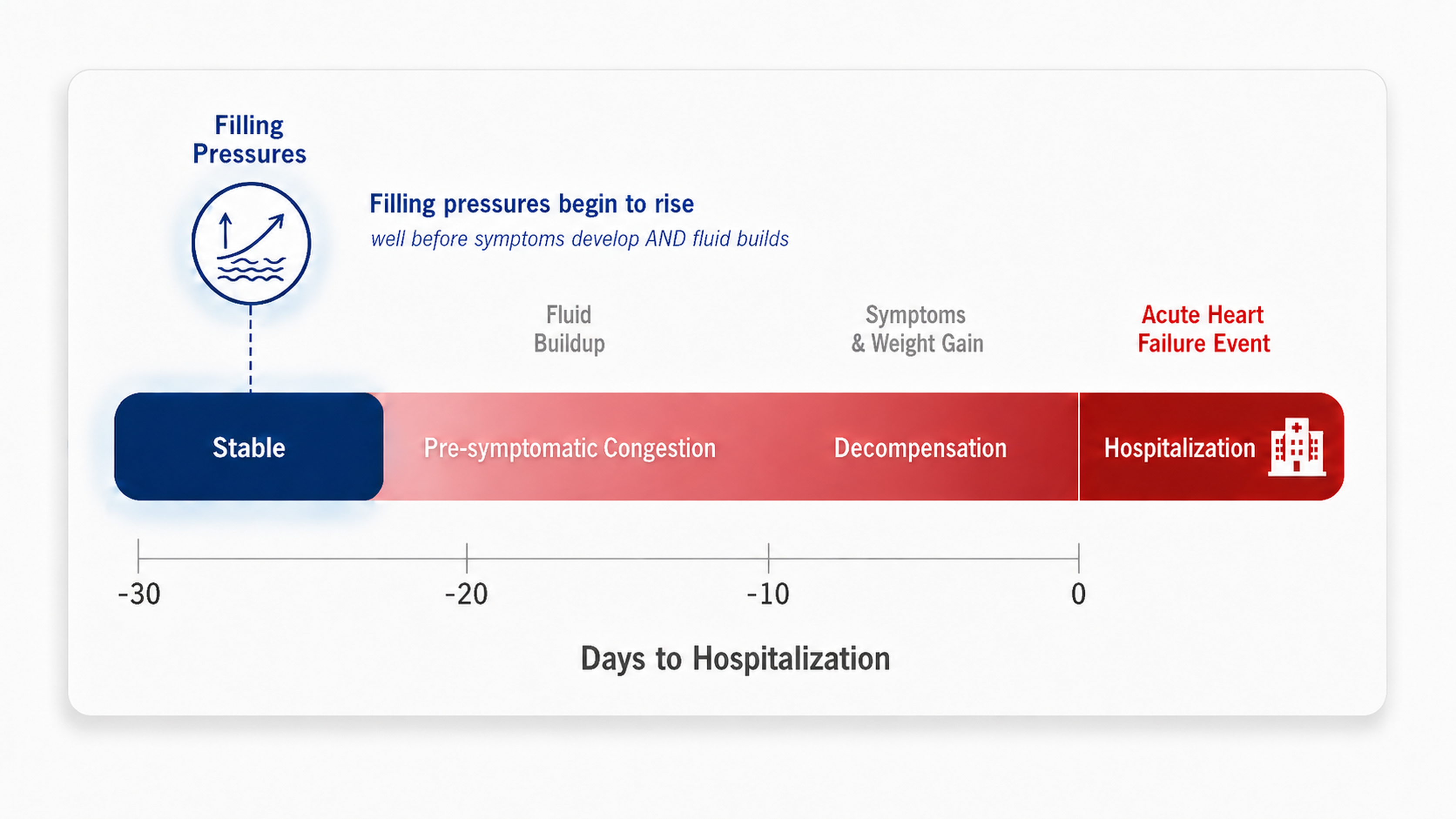Chart showing cardiac filling pressures rising up to 30 days before hospitalization — through Pre-symptomatic Congestion and Decompensation stages