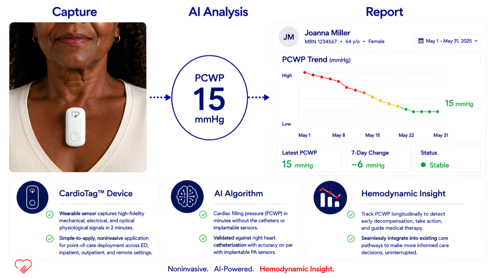 Three-step CardioTag workflow: the sensor held to a patient's chest captures signals, AI analysis produces a PCWP reading of 15 mmHg, and a clinician report shows the pressure trend over time