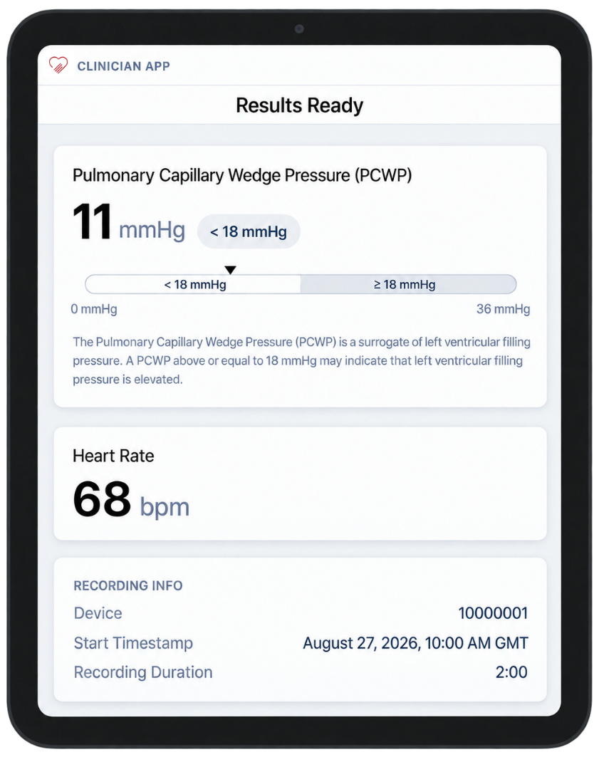 Clinician app on a tablet showing a completed recording: PCWP of 11 mmHg, classified below 18 mmHg, and a heart rate of 68 bpm